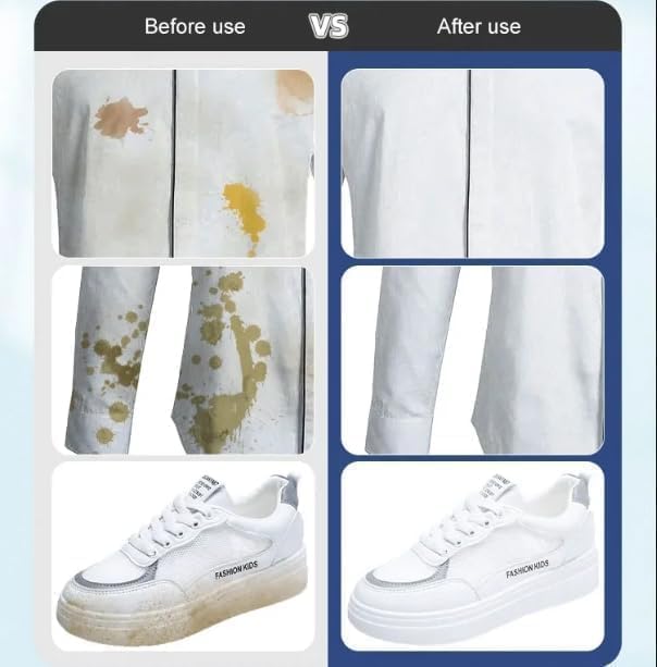 Clothes Stain Removal Wipes, 20 Pack Stain Remover - Individual Wrapped Cleaning Wipes - No Dry Cleaning Food, Grease, Coffee Off Laundry, Underwear, Fabric (1pc)