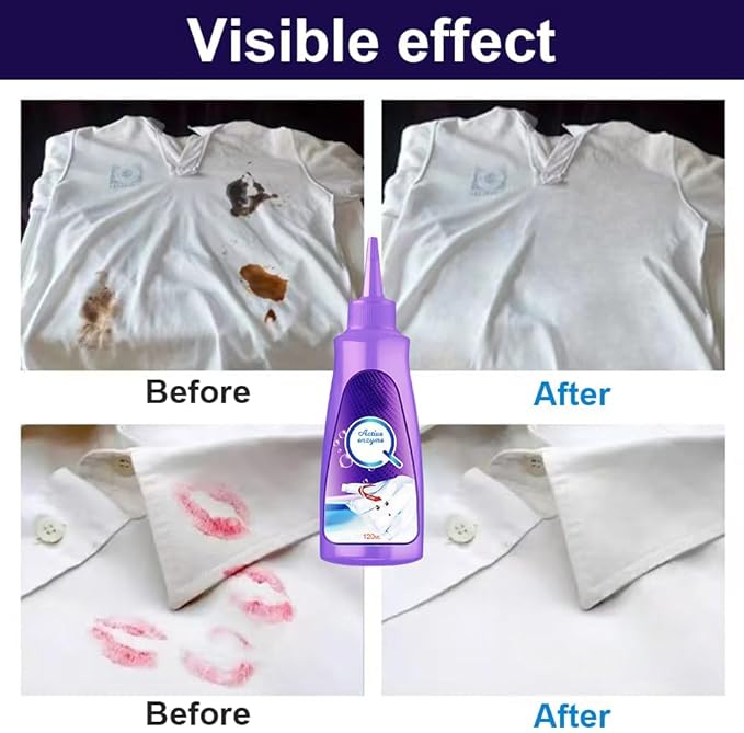 2025 Upgrade Active Enzyme Laundry Stain Remover, White Shirt Clothes Oil Stain Cleaner Remover, Stubborn Stains Cleaner, Active Enzyme Clothing Stain Remover Collar Stain Removal Spray (1)