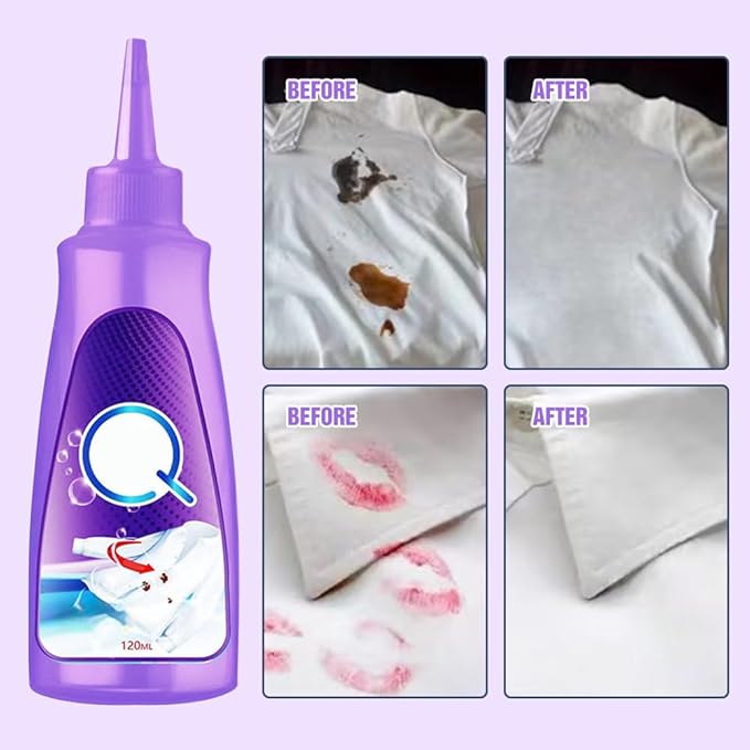 2025 Upgrade Active Enzyme Laundry Stain Remover, White Shirt Clothes Oil Stain Cleaner Remover, Stubborn Stains Cleaner, Active Enzyme Clothing Stain Remover Collar Stain Removal Spray (1)