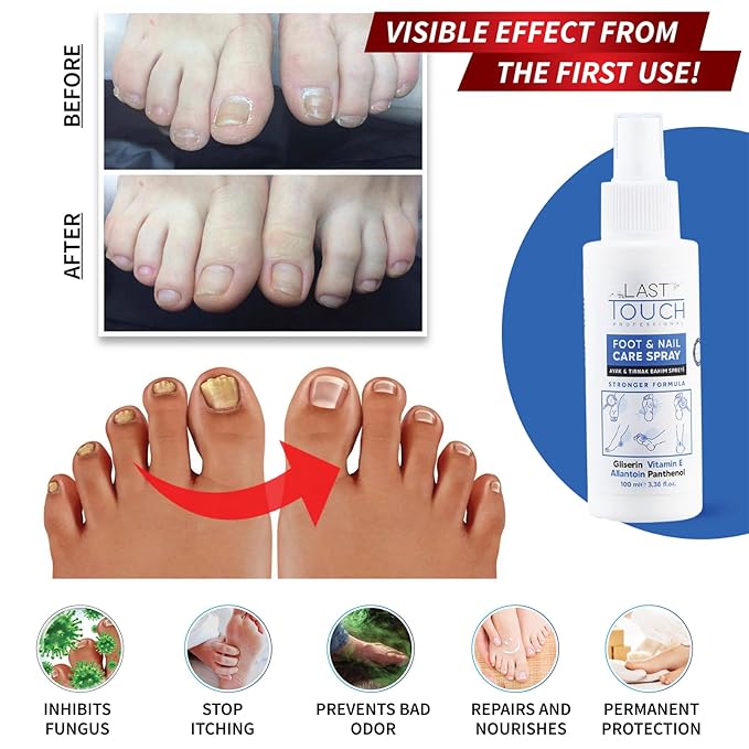 Foot Spray - Anti-Itching and Deodorizing, Moisturizing Care Spray - Foot Spray for Dry Cracked Feet - Foot Care Spray Against Shedding, Sweating, Peeling and Blistering - Athletes Foot Spray