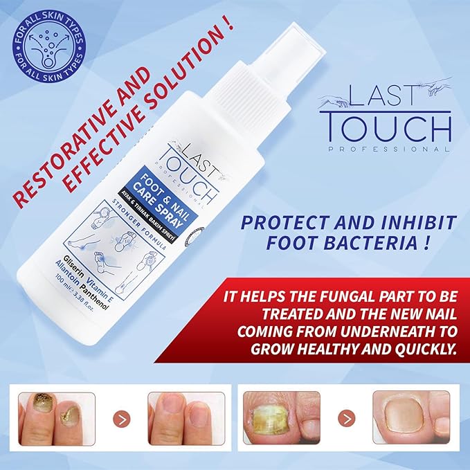 Foot Spray - Anti-Itching and Deodorizing, Moisturizing Care Spray - Foot Spray for Dry Cracked Feet - Foot Care Spray Against Shedding, Sweating, Peeling and Blistering - Athletes Foot Spray